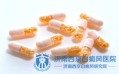 儿童白癜风患者用药时有哪些需要注意的 儿童白癜风患者用药时有哪些需要注意的