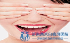 白癜风怎样自我治疗 白癜风怎样自我治疗